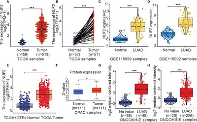 NUF2 Expression Promotes Lung Adenocarcinoma Progression and Is Associated With Poor Prognosis